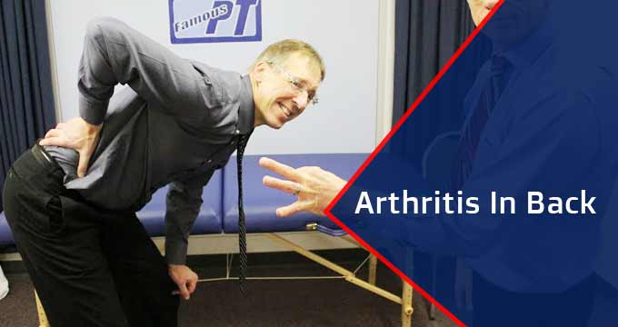 Treatments of Arthritis In Back