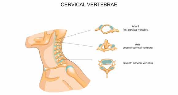Repositioning of Cervical Vertebrae